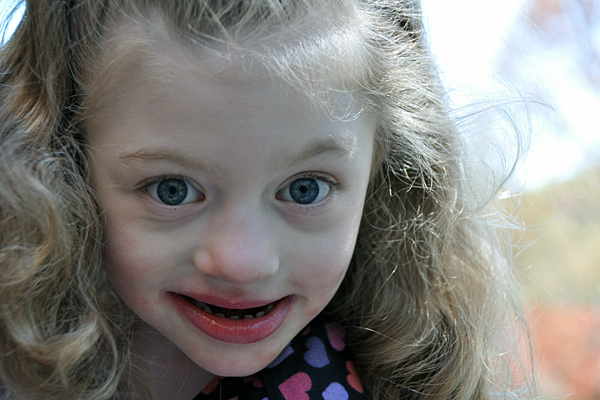 Peyton Elkins, Angelman Syndrome, clinical trial